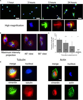 Vimentin Intermediate Filament Rings Deform the Nucleus During the First Steps of Adhesion